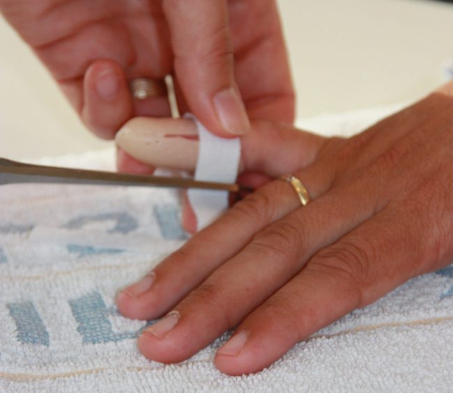 Aanleggen spalkje – Hand & Pols Centrum