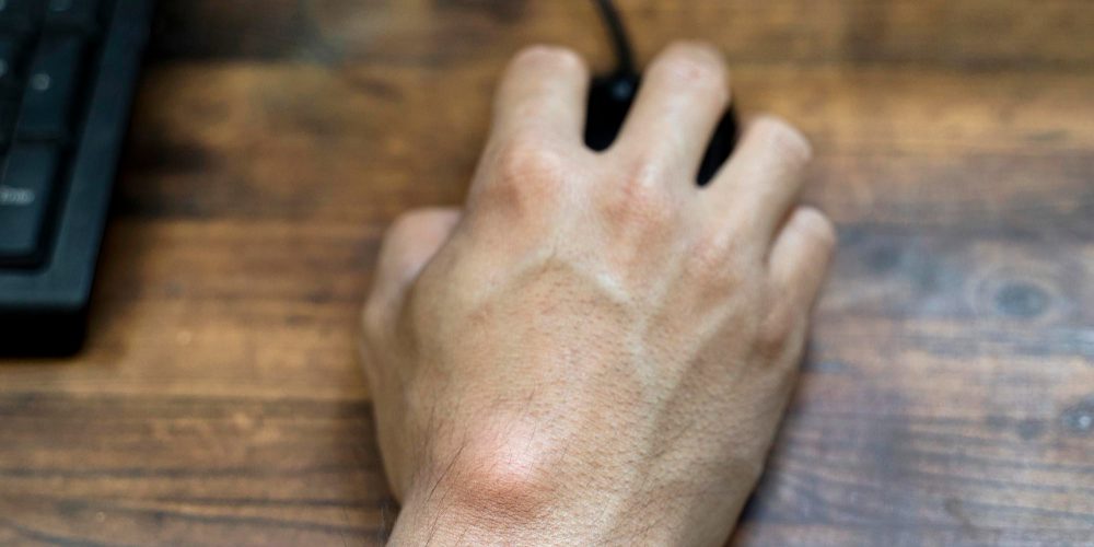 Ganglion Menneer die een muis vasthoud.