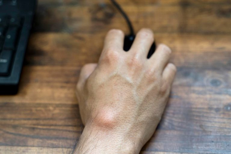 Ganglion Menneer die een muis vasthoud.